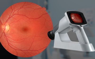 Fundus Camera